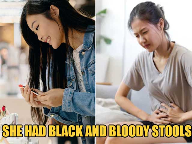 Sức khỏe đời sống - Chỉ ăn đồ rẻ tiền để tiết kiệm mua mỹ phẩm, cô gái 26 tuổi mắc ung thư dạ dày