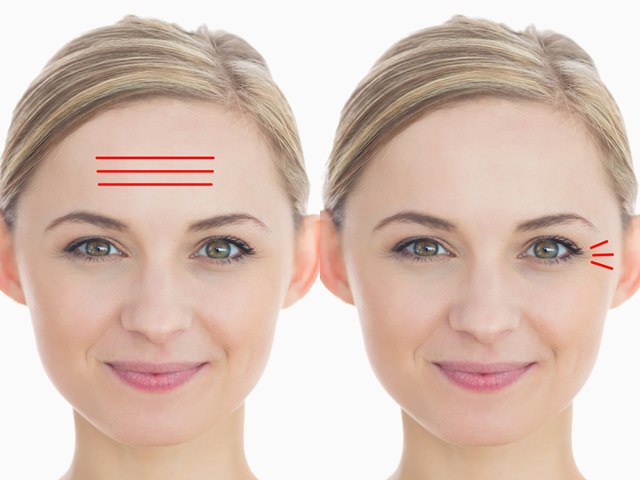 Sức khỏe đời sống - Đừng coi thường khi nếp nhăn xuất hiện ở 11 vị trí này, đây là dấu hiệu của bệnh nguy hiểm