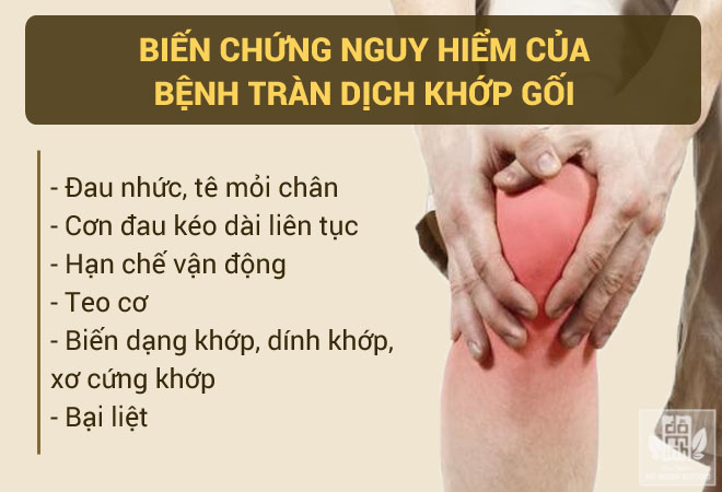 Tràn dịch khớp gối nhẹ hay nặng cũng khỏi nhờ “mẹo” chữa bệnh tư vấn bởi chuyên gia - 2