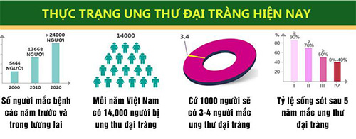Viêm đại tràng co thắt là gì? Triệu chứng và thuốc điều trị bệnh hiệu quả - 2