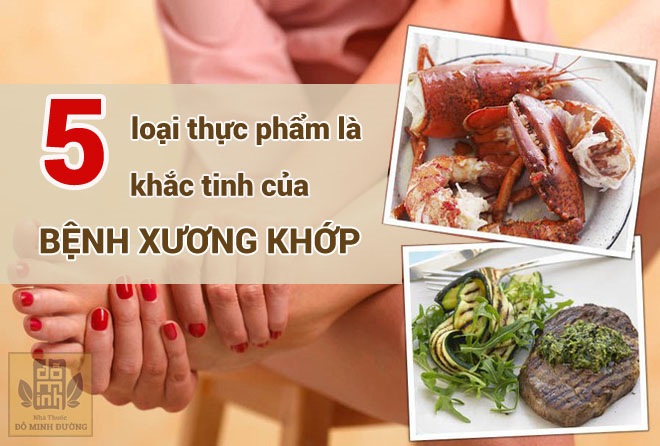 Bệnh Xương Khớp Kiêng Gì?