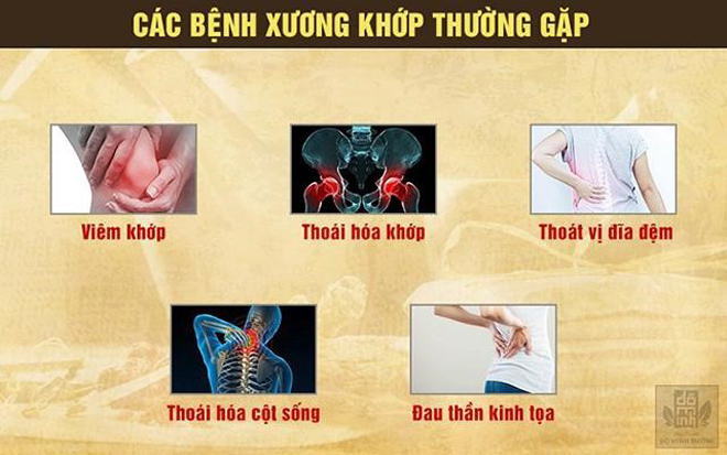 Đau nhức xương khớp dùng thuốc gì để khỏi bệnh hoàn toàn? - 1