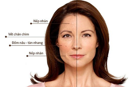 Những dấu hiệu lão hóa trên da chứng tỏ bạn đã "có tuổi"