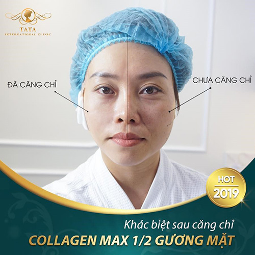 Những dấu hiệu lão hóa trên da chứng tỏ bạn đã "có tuổi" - 3