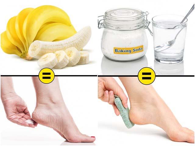 Làm đẹp - 9 cách đơn giản chữa nứt gót chân cực nhanh mùa hanh khô