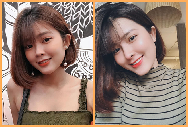 Phòng khám nâng mũi AZ NOSE tiên phong xu hướng cá nhân hóa dáng mũi - 3