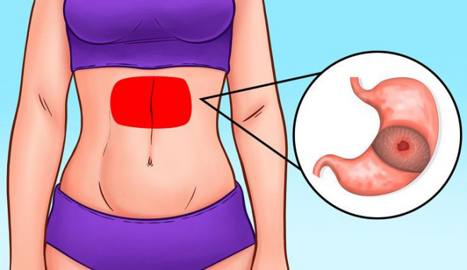 Rau súp lơ cực tốt, nhưng ăn theo cách này mới bổ nhất - 3