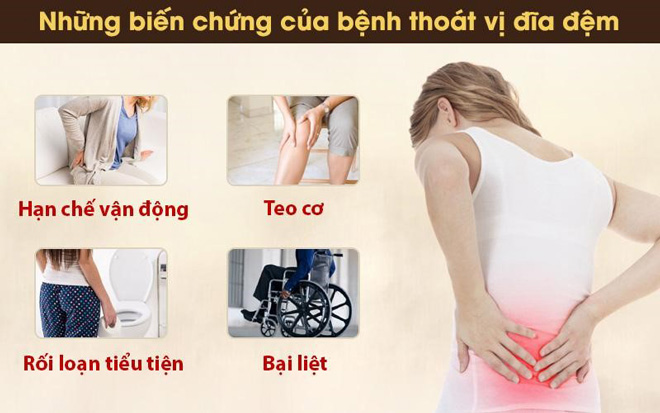 Bệnh thoát vị đĩa đệm có nguy hiểm không? Có chữa khỏi được không? Chuyên gia giải đáp - 1
