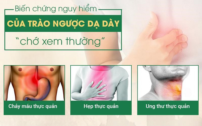 Triệu chứng trào ngược dạ dày: Những biến chứng khó lường và cách điều trị - 2