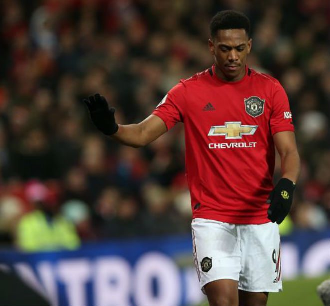 Martial có thể ra sân nhưng chưa chắc đá chính ở derby thành Manchester đêm mai