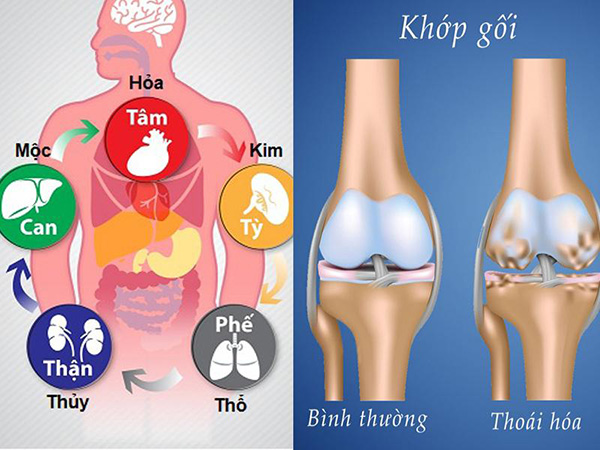 Điều trị thoái hóa khớp gối bằng Đông y đơn giản, hiệu quả và không cần phẫu thuật - 2