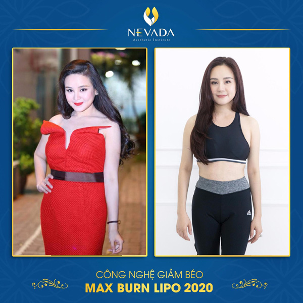 Ca sĩ Vy Oanh giảm cân thành công nhờ Max Burn Lipo