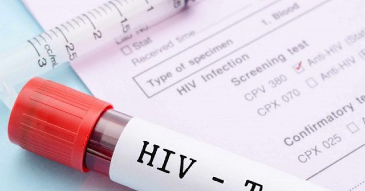 Sức khỏe đời sống - Xét nghiệm HIV cách nào chính xác nhất?