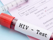 Sức khỏe đời sống - Xét nghiệm HIV cách nào chính xác nhất?