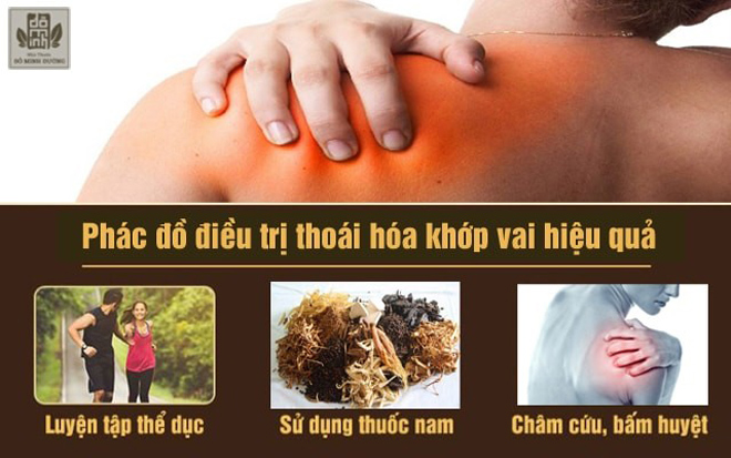 Thoái hóa khớp vai và cách điều trị hiệu quả, ngăn ngừa nguy cơ tàn phế từ thảo dược - 2