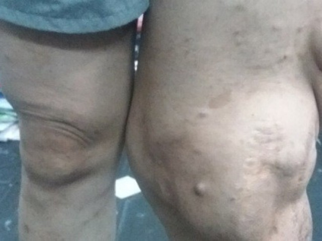 Sức khỏe đời sống - "Chuyện lạ" thầy giáo vật lý 20 năm mặc quần... ống lớn ống nhỏ!