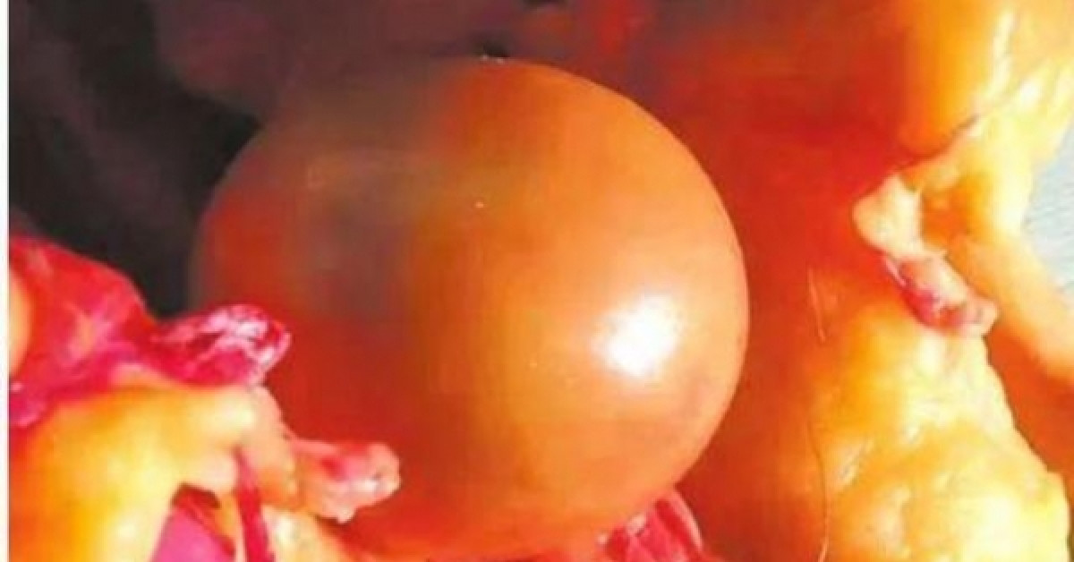 Ẩm thực - Mổ con vịt đực nuôi 5 năm, "ẵm" bảo bối trong bụng ngang cả gia tài