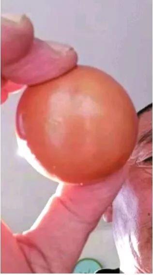 Mổ con vịt đực nuôi 5 năm, &#34;ẵm&#34; bảo bối trong bụng ngang cả gia tài - 2