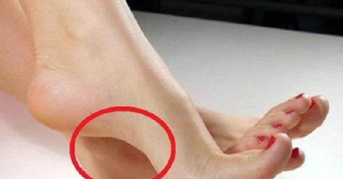 Bạn trẻ - Cuộc sống - Bàn chân có nét tướng này báo hiệu bạn sắp giàu to, tiền về ngập nhà