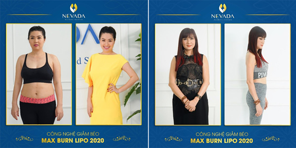 Diễn viên Lê Khánh và “nữ hoàng ảnh lịch” Hiền Mai trước và sau khi sử dụng Max Burn Lipo