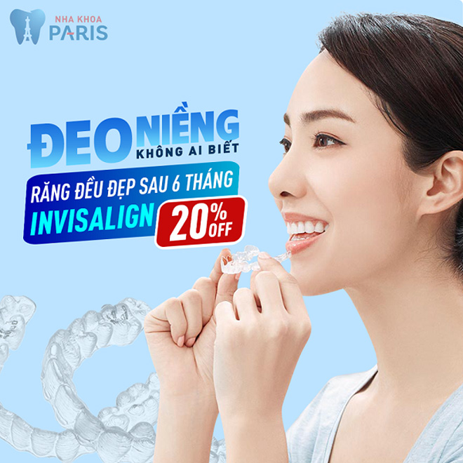 Nên niềng Invisalign trước tết Nguyên Đán