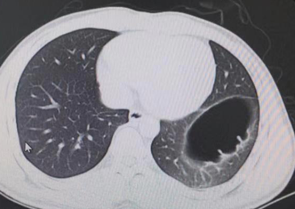 Bạn gái đùa đánh vào bụng, chàng trai nhập viện trong tình trạng nội tạng thay đổi - 1