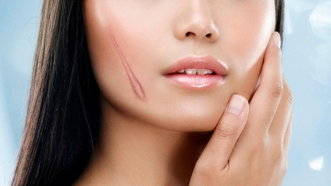How to effectively reduce perennial scars with super savings - 2