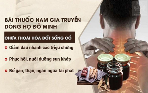 Danh y tiết lộ cách chữa thoái hóa đốt sống cổ hiệu quả, tránh nguy cơ tàn phế - 3