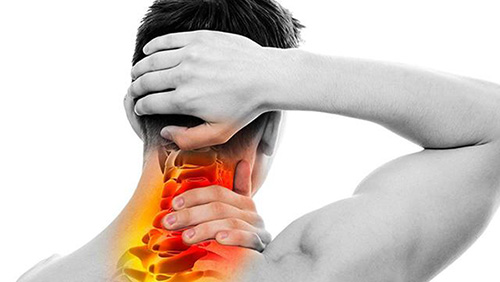 Thoái hóa đốt sống cổ uống thuốc gì tốt hiện nay? - 1