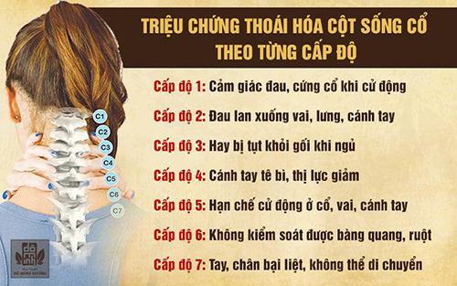Triệu chứng thoái hóa đốt sống cổ, lưng và cách điều trị khỏi từ thảo dược - 1