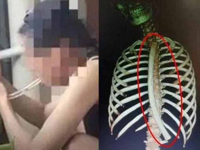 Bạn trẻ - Cuộc sống - Học mẹo giảm cân trên mạng, cô gái gặp cái kết nhớ đời