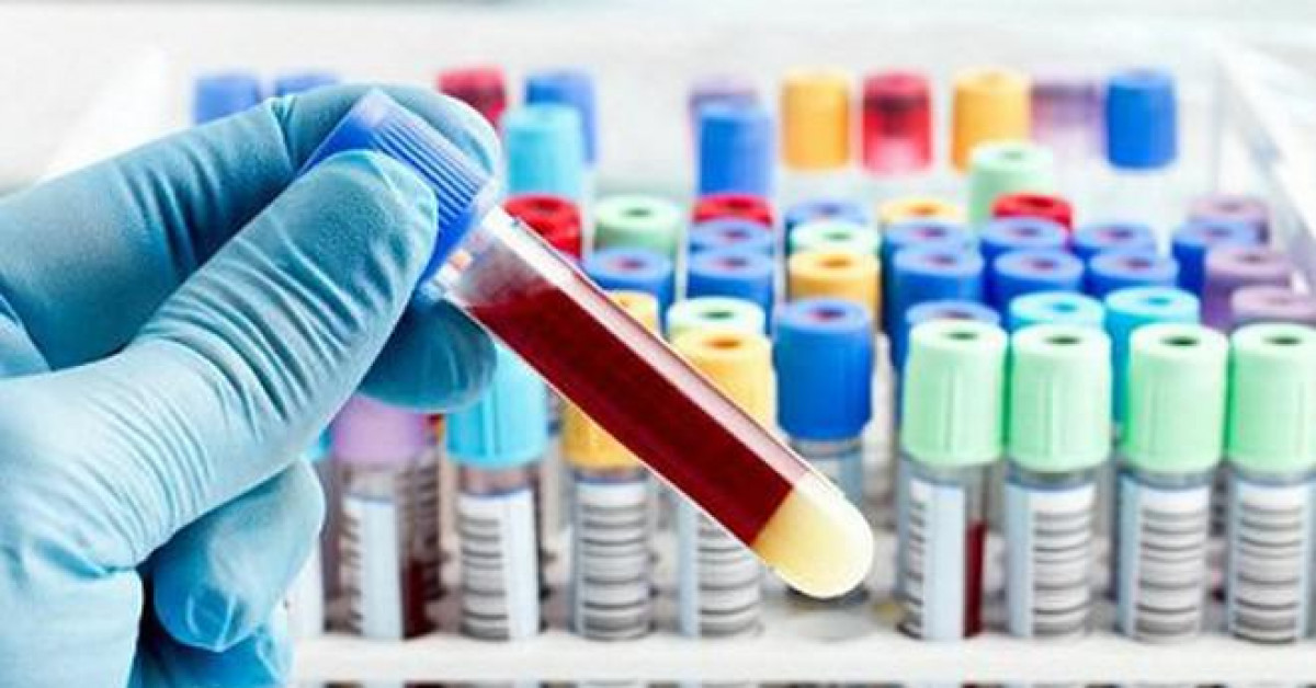 Sức khỏe đời sống - Sự thật về xét nghiệm máu phát hiện nhiều bệnh ung thư cùng lúc