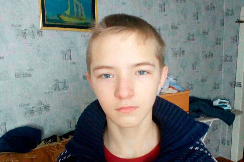 Thiếu niên Nga thành “bó đuốc sống” vì chạm vào dây điện 27.000 volt - 2