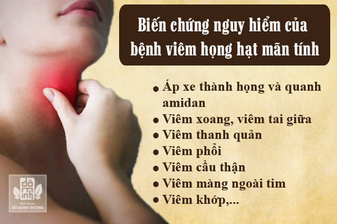 Viêm họng hạt mãn tính có thể chữa khỏi bằng bài thuốc Nam Đỗ Minh Đường không? - 2