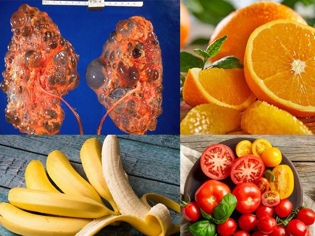 Sức khỏe đời sống - 12 "món" siêu bổ dưỡng nhưng lại là "hung thần" của người thận yếu