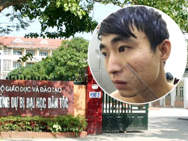 Pháp luật - Hé lộ nguyên nhân nữ sinh 19 tuổi bị người yêu giết trong nhà nghỉ