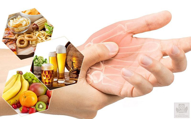 Viêm khớp dạng thấp kiêng ăn gì và nên ăn gì để không đau nhức, mau hết bệnh? - 1