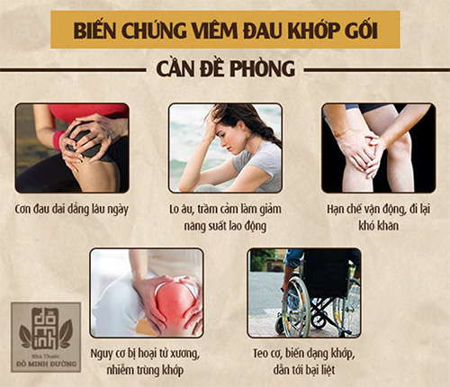 Top 3 phương pháp chữa viêm đau khớp gối phổ biến, đâu là cách hiệu quả? - 2