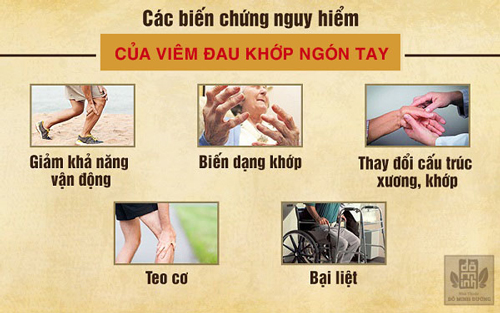 Viêm đau khớp ngón tay và cách chữa hiệu quả phòng ngừa biến chứng - 1