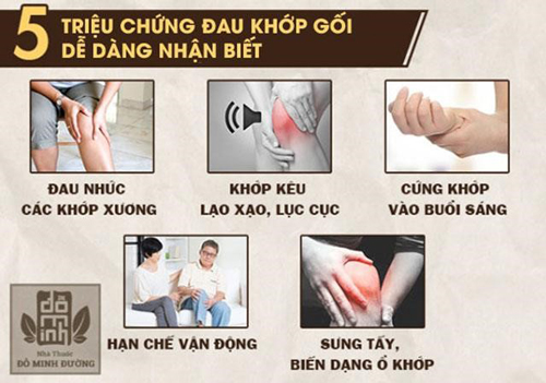 Đau đầu gối trái, phải cảnh báo bệnh gì? Cách điều trị giúp thoải mái vận động - 1