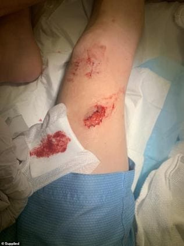 Nạn nhân bị một vết rách lớn ở chân sau vụ việc