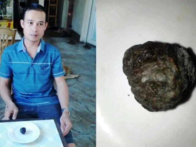 Tin tức trong ngày - Mổ dê 10 năm tuổi, phát hiện vật thể nghi “dương bảo”