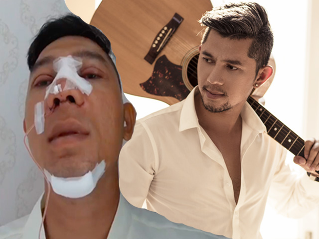 Làm đẹp - Trào lưu nam giới phẫu thuật thẩm mỹ 2019: Người trong cuộc nói gì?