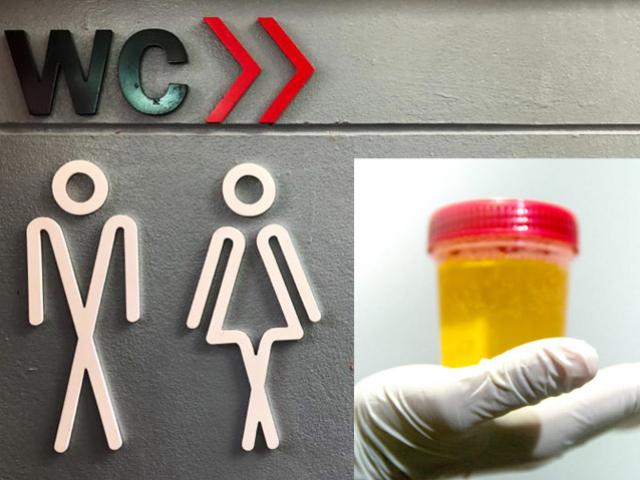 Sức khỏe đời sống - 10 dấu hiệu thận yếu ai cũng cần biết, đừng để đến lúc bác sĩ cắt bỏ mới tự trách mình