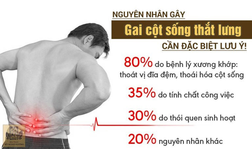 Bệnh gai cột sống thắt lưng: Cần sớm điều trị để tránh nguy cơ tàn phế - 1