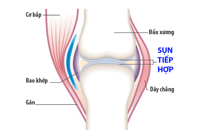 Sụn tiếp hợp quyết định tốc độ phát triển chiều dài của xương