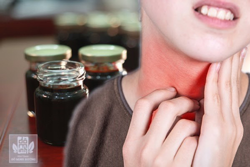 Chẳng cần phẫu thuật cũng khỏi viêm amidan hốc mủ nhờ thuốc nam Đỗ Minh Đường - 1