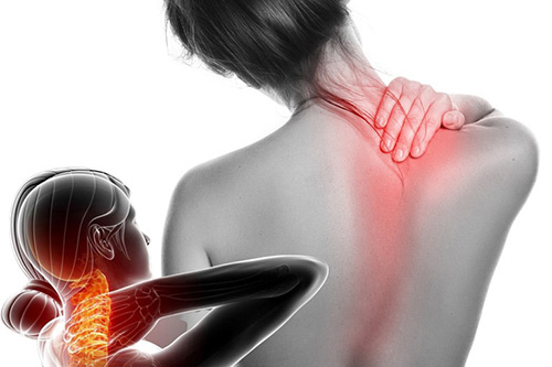 Đau vai gáy bên trái, phải là bệnh gì và cách điều trị hiệu quả tận gốc - 1