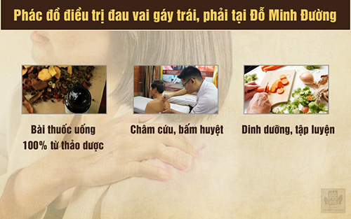 Đau vai gáy bên trái, phải là bệnh gì và cách điều trị hiệu quả tận gốc - 3