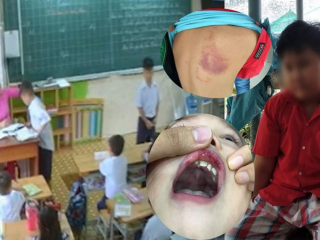 Giáo dục - du học - Những vụ giáo viên đánh tới tấp học sinh gây chấn động năm 2019